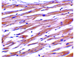 UNG1 Antibody in Immunohistochemistry (Paraffin) (IHC (P))