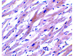 UNG1 Antibody in Immunohistochemistry (Paraffin) (IHC (P))