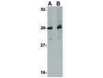 UROP11 Polyclonal Antibody