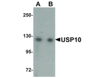 USP10 Antibody in Western Blot (WB)