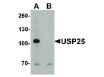 USP25 Antibody in Western Blot (WB)