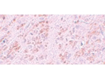 VENTX Antibody in Immunohistochemistry (Paraffin) (IHC (P))