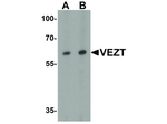 VEZT Antibody in Western Blot (WB)