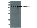 Vinculin Polyclonal Antibody