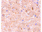 VISA Antibody in Immunohistochemistry (Paraffin) (IHC (P))