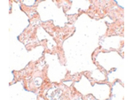 VLK Antibody in Immunohistochemistry (Paraffin) (IHC (P))