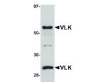 VLK Antibody in Western Blot (WB)