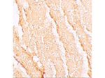 VPS39 Antibody in Immunohistochemistry (Paraffin) (IHC (P))