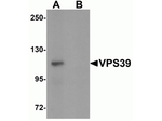 VPS39 Antibody in Western Blot (WB)