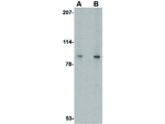 VPS53 Antibody in Western Blot (WB)