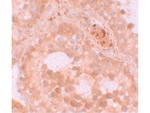 WDR92 Antibody in Immunohistochemistry (Paraffin) (IHC (P))