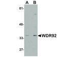WDR92 Antibody in Western Blot (WB)