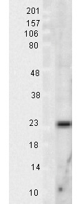 SOD2 Antibody in Western Blot (WB)