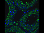 ACE2 Antibody in Immunocytochemistry (ICC/IF)