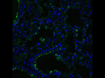 ACE2 Antibody in Immunocytochemistry (ICC/IF)