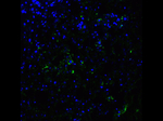 ACE2 Antibody in Immunocytochemistry (ICC/IF)
