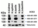 ACE2 Antibody in Western Blot (WB)