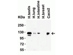 ACE2 Antibody in Western Blot (WB)
