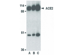 ACE2 Antibody in Western Blot (WB)