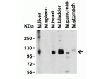 ACE2 Antibody in Western Blot (WB)