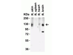 ACE2 Antibody in Western Blot (WB)
