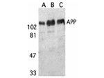 APP Antibody in Western Blot (WB)