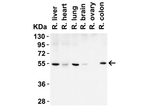 BECLIN1 Antibody in Western Blot (WB)