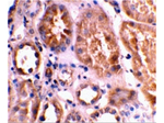 BNIP3L Antibody in Immunohistochemistry (Paraffin) (IHC (P))