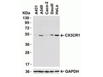 CX3CR1 Antibody in Western Blot (WB)