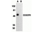 CX3CR1 Antibody in Western Blot (WB)