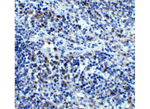 CXCR4 Antibody in Immunohistochemistry (Paraffin) (IHC (P))
