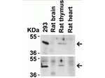 CXCR4 Antibody in Western Blot (WB)