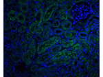 DcR2 Polyclonal Antibody
