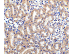 DcR2 Antibody in Immunohistochemistry (Paraffin) (IHC (P))