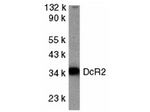 DcR2 Antibody in Western Blot (WB)