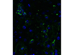 DR5 Polyclonal Antibody