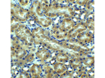 DR5 Antibody in Immunohistochemistry (Paraffin) (IHC (P))