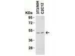 DR5 Antibody in Western Blot (WB)