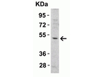 DR5 Antibody in Western Blot (WB)