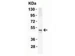 DR5 Antibody in Western Blot (WB)