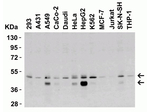 DR5 Antibody in Western Blot (WB)