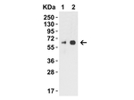 H1N1 Neuraminidase Polyclonal Antibody
