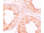 YBX2 Antibody in Immunohistochemistry (Paraffin) (IHC (P))
