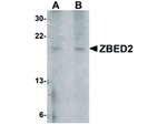 ZBED2 Antibody in Western Blot (WB)