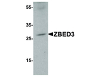 ZBED3 Polyclonal Antibody