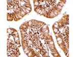 ZBP1 Antibody in Immunohistochemistry (Paraffin) (IHC (P))