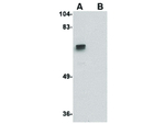 ZBRK1 Polyclonal Antibody