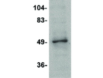 ZBTB2 Polyclonal Antibody