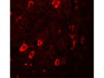 ZBTB3 Polyclonal Antibody