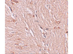 ZBTB4 Antibody in Immunohistochemistry (Paraffin) (IHC (P))